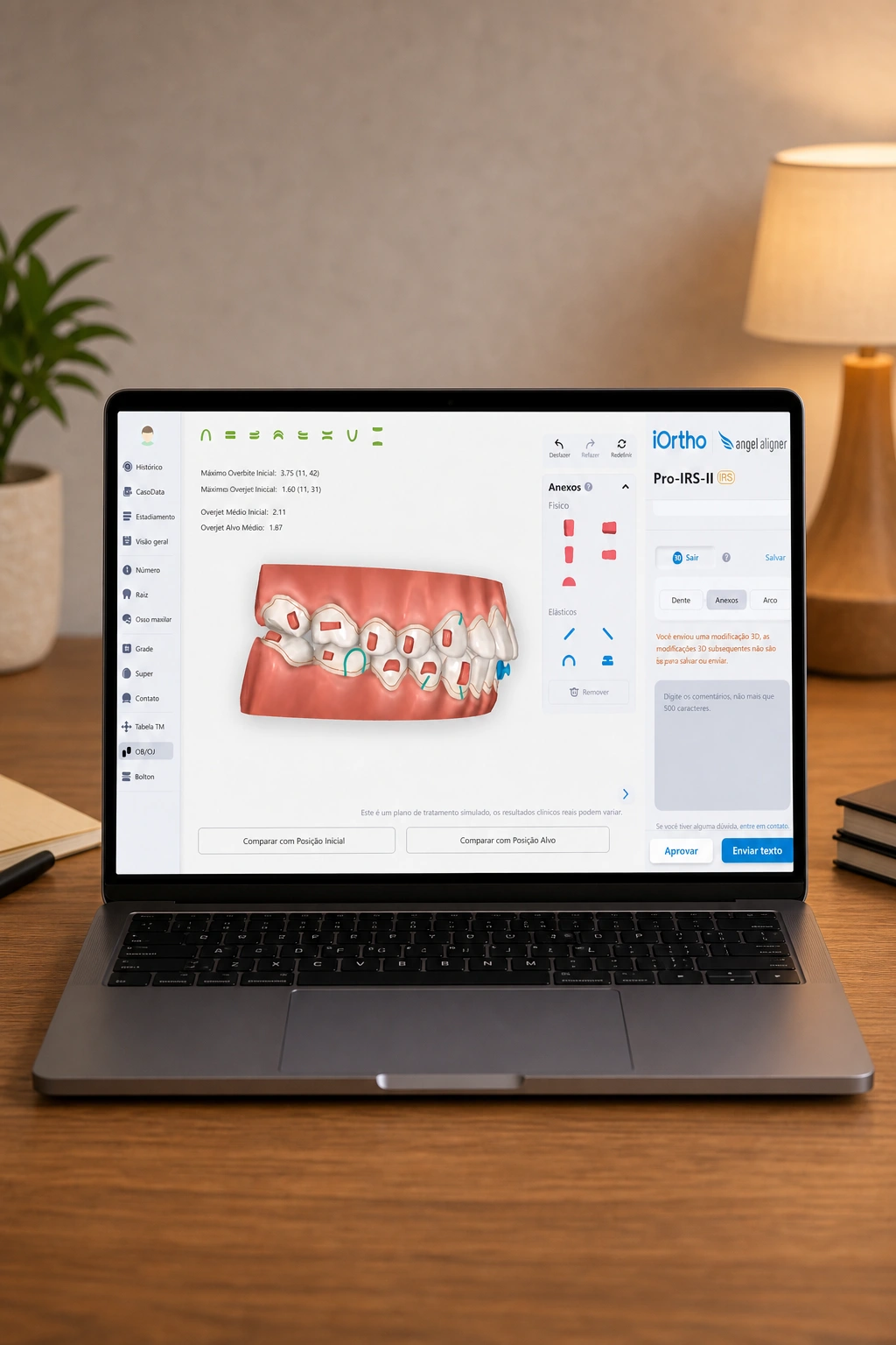 Planejamento 3D do sorriso no software iOrtho da Angel Aligner